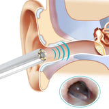 Ear Cleaning Endoscope